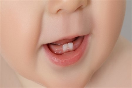 دندان های شیری نوزادان