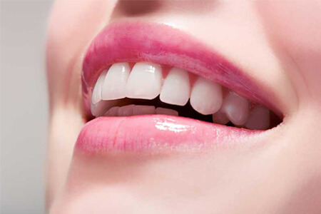 سفید کردن سریع دندان ها در خانه
